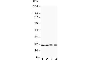 Image no. 1 for anti-Caveolin 1, Caveolae Protein, 22kDa (CAV1) (AA 4-178) antibody (ABIN3030338)