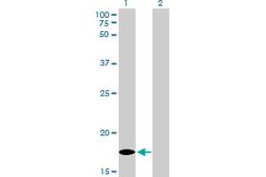 Western Blot analysis of MCFD2 expression in transfected 293T cell line by MCFD2 monoclonal antibody (M01), clone 3A5-G4.