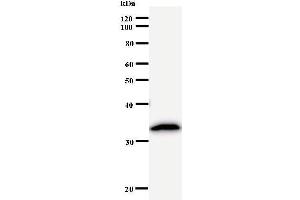 Image no. 2 for anti-Proteasome (Prosome, Macropain) 26S Subunit, ATPase, 5 (PSMC5) antibody (ABIN933121)