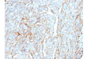 Image no. 6 for anti-CD274 (PD-L1) (AA 39-191) antibody (ABIN6939571)