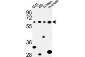 Image no. 1 for anti-Phospholipase C zeta 1 (PLCz1) antibody (ABIN3004174)
