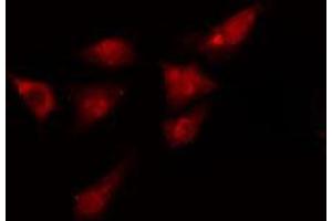 Image no. 1 for anti-Kinesin Family Member 4A (KIF4A) antibody (ABIN6257303)