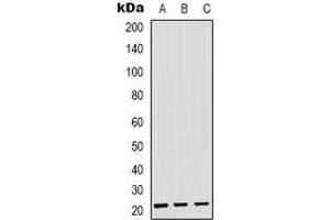 Image no. 2 for anti-SAR1 Homolog B (SAR1B) antibody (ABIN2801329)