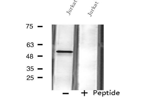 anti-Fukutin Related Protein (FKRP) (N-Term) antibody