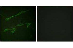 Immunofluorescence analysis of NIH-3T3 cells, using VAV2 (Phospho-Tyr142) Antibody.