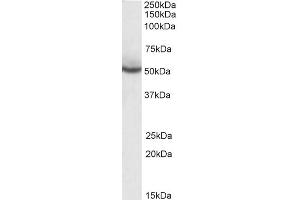 Image no. 2 for anti-Peroxisome Proliferator-Activated Receptor delta (PPARD) (C-Term) antibody (ABIN185282)