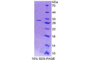 Image no. 1 for Protein tyrosine Phosphatase, Receptor Type, H (PTPRH) (AA 685-909) protein (His tag) (ABIN2126545)