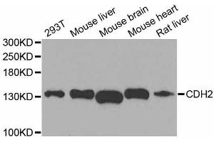 Western blot analysis of extracts of various cell lines, using CDH2 antibody.