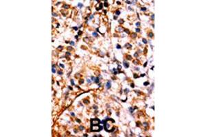 Image no. 2 for anti-Nuclear Factor kappa B (NFkB) (pSer536) antibody (ABIN389601)