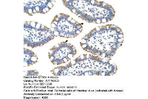 Image no. 2 for anti-Splicing Factor 3b, Subunit 4, 49kDa (SF3B4) (N-Term) antibody (ABIN2778952)