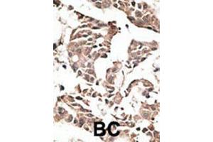 Image no. 3 for anti-Autophagy related 4C Cysteine Peptidase (ATG4C) (AA 33-62), (N-Term) antibody (ABIN388503)