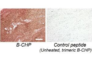 Following heat-mediated antigen retrieval, the complete collagen content in a formalin-fixed (FFPE) section of porcine ligament is visualized non-fluorescently via immunohistochemistry using B-CHP, which is further detected by horseradish peroxidase (HRP) conjugate of NeutrAvidin.
