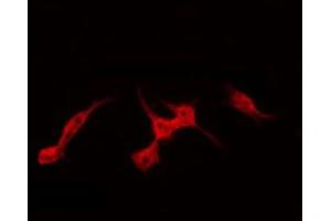 Image no. 1 for anti-S100 Calcium Binding Protein Z (S100Z) (Internal Region) antibody (ABIN6257804)