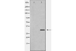 Image no. 1 for anti-HCLS1 Associated Protein X-1 (HAX1) (C-Term) antibody (ABIN6262152)