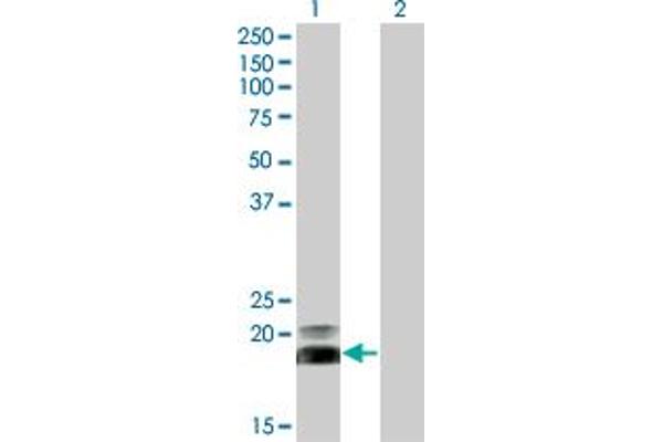 anti-Heart and Neural Crest Derivatives Expressed 2 (HAND2) (AA 135-216) antibody