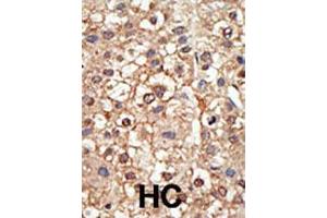 Image no. 2 for anti-Protein Inhibitor of Activated STAT, 4 (PIAS4) (AA 48-79), (N-Term) antibody (ABIN388061)