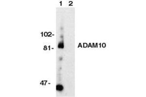 Image no. 1 for anti-ADAM Metallopeptidase Domain 10 (ADAM10) (C-Term) antibody (ABIN6655245)