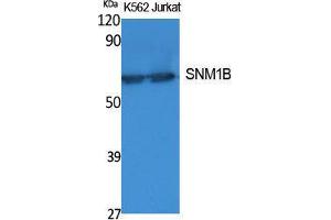Image no. 1 for anti-DNA Cross-Link Repair 1B (DCLRE1B) (C-Term) antibody (ABIN3187627)