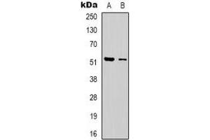 Image no. 3 for anti-erythrocyte Membrane Protein Band 4.9 (Dematin) (EPB49) (C-Term) antibody (ABIN2801198)
