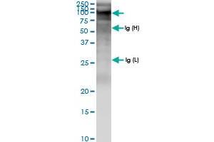 Image no. 1 for anti-Zinc Finger, FYVE Domain Containing 9 (ZFYVE9) (AA 1-762) antibody (ABIN948795)