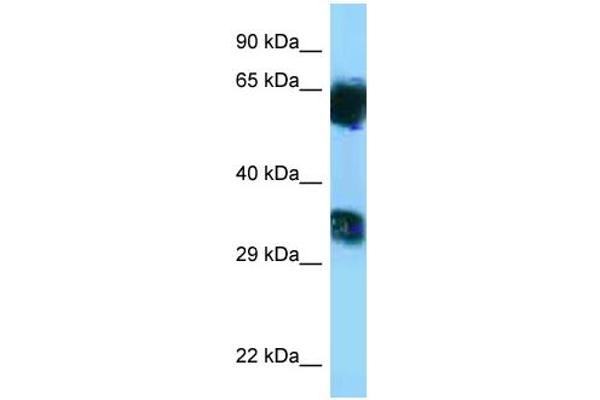 anti-Mannosyl (Alpha-1,6-)-Glycoprotein beta-1,6-N-Acetyl-Glucosaminyltransferase, Isozyme B (MGAT5B) (C-Term) antibody