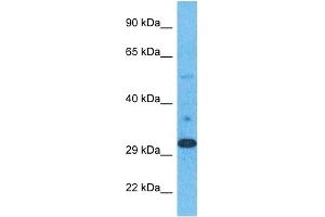 Image no. 1 for anti-ELOVL Fatty Acid Elongase 1 (ELOVL1) (N-Term) antibody (ABIN5514396)
