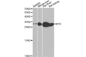 Image no. 3 for anti-Erythropoietin (EPO) antibody (ABIN6140232)