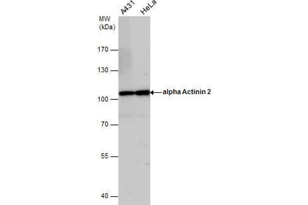 anti-Actinin, alpha 2 (ACTN2) (Center) antibody