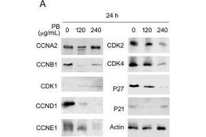 Image no. 8 for anti-Cyclin-Dependent Kinase Inhibitor 1B (p27, Kip1) (CDKN1B) (Center) antibody (ABIN2854753)