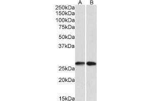 Image no. 1 for anti-Nicotinamide N-Methyltransferase (NNMT) (N-Term) antibody (ABIN5539743)