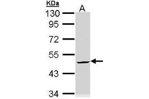 Image no. 3 for anti-Keratin 20 (KRT20) (Internal Region) antibody (ABIN2856768)