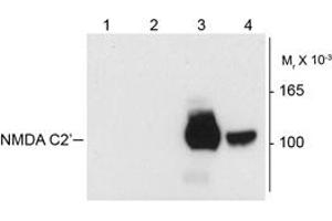 Image no. 1 for anti-NMDA Receptor 1 (NMDA R1) (Splice Variant C2') antibody (ABIN372677)