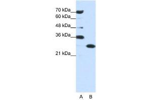 Image no. 3 for anti-Acidic (Leucine-Rich) Nuclear phosphoprotein 32 Family, Member A (ANP32A) (Middle Region) antibody (ABIN2778667)