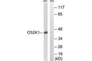 Image no. 1 for anti-Olfactory Receptor, Family 52, Subfamily K, Member 1 (OR52K1) (AA 201-250) antibody (ABIN1536047)