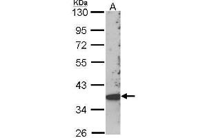 Image no. 3 for anti-Src Kinase Associated Phosphoprotein 2 (SKAP2) (C-Term) antibody (ABIN2856343)