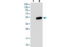 Image no. 2 for anti-PHD Finger Protein 13 (PHF13) antibody (ABIN5585611)