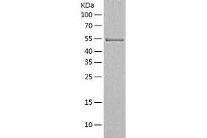 Western Blotting (WB) image for Ribophorin II (RPN2) (AA 23-540) protein (His tag) (ABIN7124877)