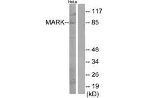 Image no. 1 for anti-MAP/microtubule Affinity-Regulating Kinase 1 (MARK1) (AA 121-170) antibody (ABIN1534160)