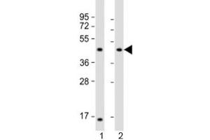 Image no. 1 for anti-Lipoic Acid Synthetase (LIAS) (AA 298-330) antibody (ABIN5647254)