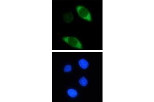 Image no. 1 for anti-CRISPR-Cas9 (N-Term) antibody (ABIN2668367)
