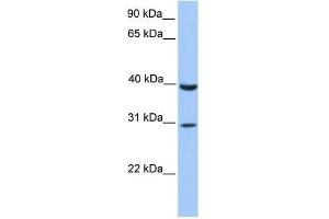 Image no. 1 for anti-JAZF Zinc Finger 1 (JAZF1) (C-Term) antibody (ABIN927909)