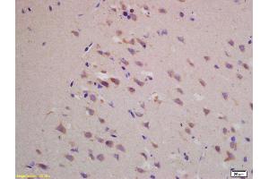 Formalin-fixed and paraffin embedded rat brain labeled with Rabbit Anti BACE1/ASP2 Polyclonal Antibody, Unconjugated (ABIN725705) at 1:200 followed by conjugation to the secondary antibody and DAB staining