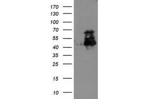 Image no. 1 for anti-ELK3, ETS-Domain Protein (SRF Accessory Protein 2) (ELK3) antibody (ABIN1498007)