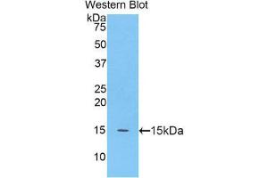 Image no. 1 for anti-Meningioma Expressed Antigen 5 (Hyaluronidase) (MGEA5) (AA 695-814) antibody (ABIN1859959)