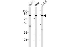 Image no. 2 for anti-Inhibitor of kappa Light Polypeptide Gene Enhancer in B-Cells, Kinase beta (IKBKB) antibody (ABIN387826)