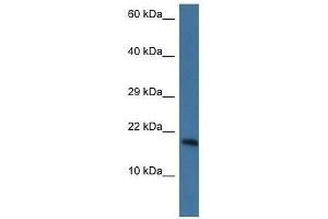 Image no. 1 for anti-Paroxysmal Nonkinesigenic Dyskinesia (PNKD) (N-Term) antibody (ABIN928070)