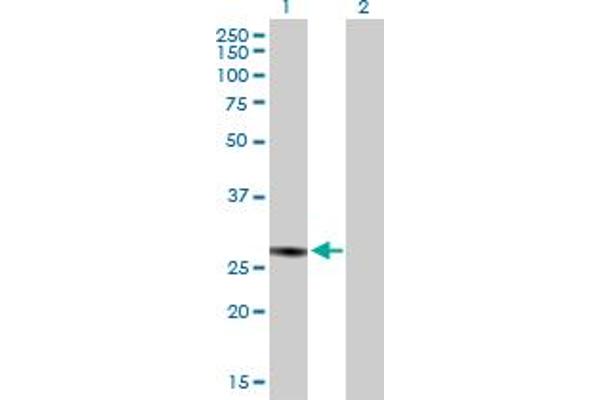 anti-Complement Component 1, Q Subcomponent Binding Protein (C1QBP) (AA 1-282) antibody