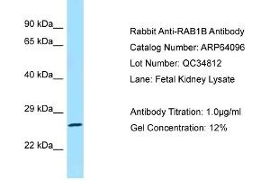 Image no. 2 for anti-RAB1B, Member RAS Oncogene Family (RAB1B) (C-Term) antibody (ABIN2774390)