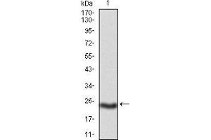 PKHD1 抗体  (AA 3878-4060)