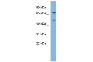 Image no. 1 for anti-Glutamine-Fructose-6-Phosphate Transaminase 2 (GFPT2) (Middle Region) antibody (ABIN632223)